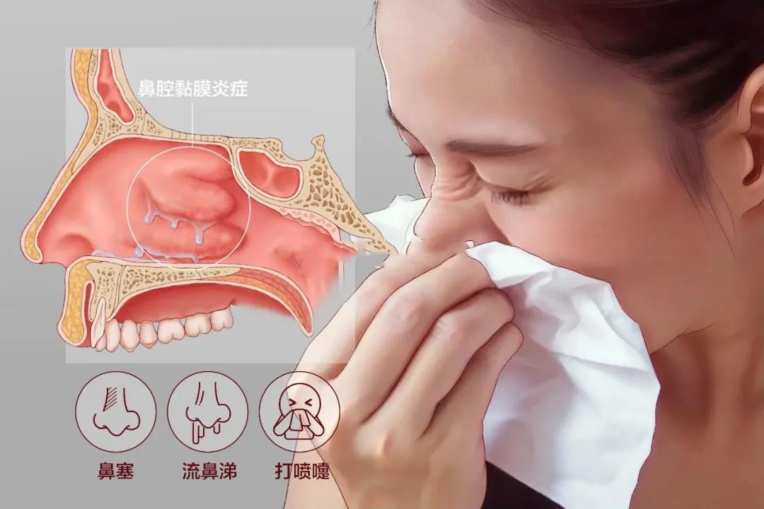 重庆鼻炎专科医院